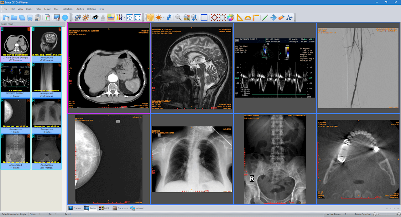 SanteDicomViewer - Presented by PostDICOM